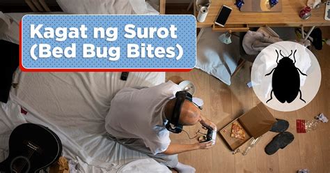 bed bugs in tagalog|Kagat ng Surot (Bed Bug Bites) .